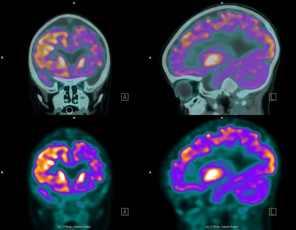 Picture of an CT Scan procedure