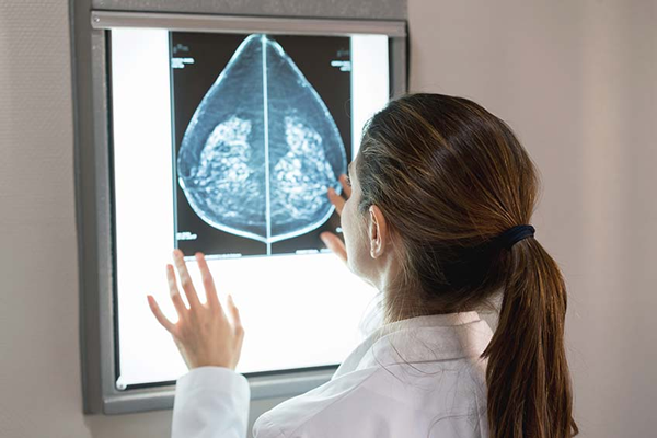 Picture of a 3D Mammogram screen