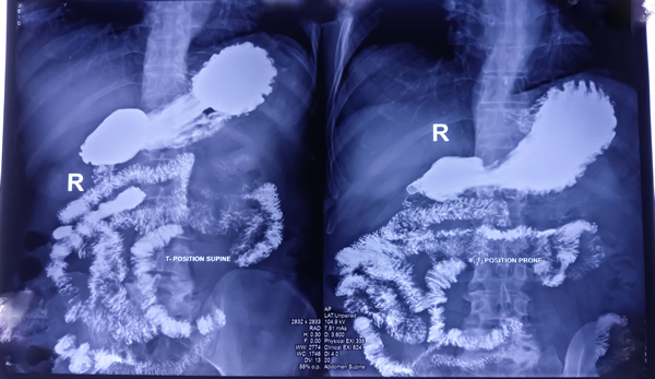 Picture of an CT Scan screen